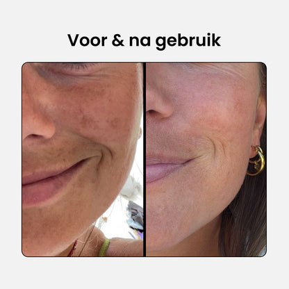 10% Niacinamide Serum